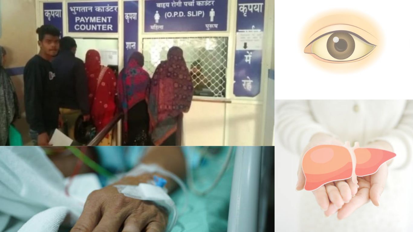 रुड़की: गाधारोना गांव में काला पीलिया का क़हर, तीन महीनों में 470 मरीज संक्रमित